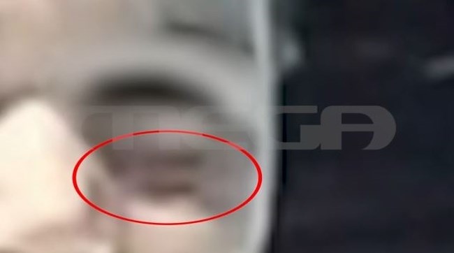 Αστυνομικός Βουλή: Σοκάρουν οι φωτογραφίες  από την κακοποίηση του 14χρονου γιου του - Ντοκουμέντα από τα χτυπήματα