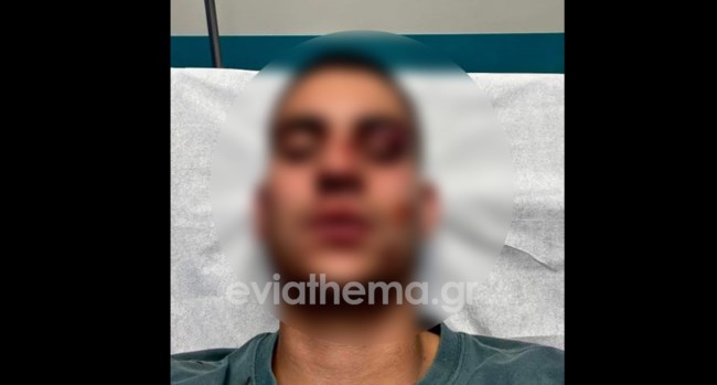 Απίστευτο: Εστειλε 19χρονο στο νοσοκομείο Χαλκίδας με κατάγματα επειδή έκανε ένα "like" στην κοπέλα του