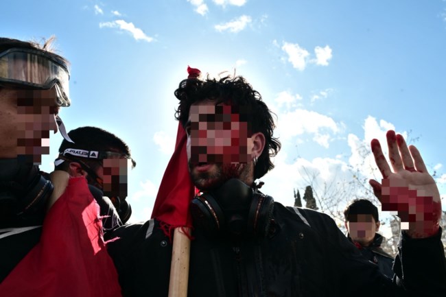 ΕΠΕΙΣΟΔΙΑ ΤΡΑΥΜΑΤΙΕΣ
