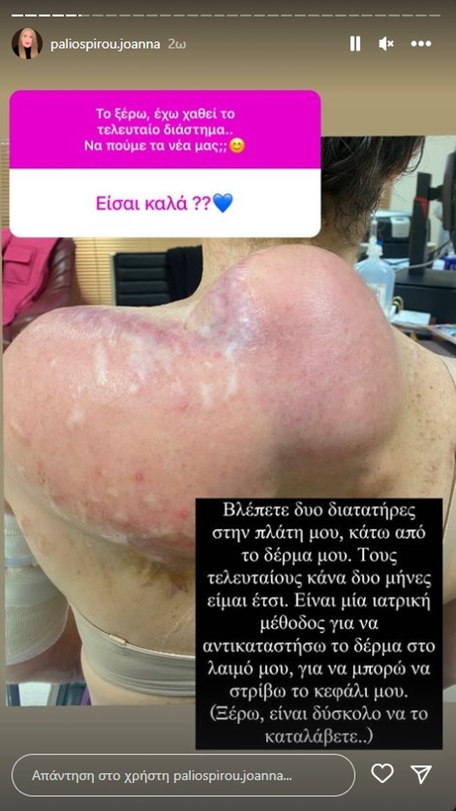 Ιωάννα Παλιοσπύρου