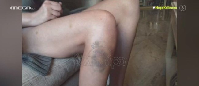 Ναστάζια Μητροπούλου: Κόντεψα να μείνω παράλυτη από την κακοποίηση του πρώην συντρόφου μου [εικόνες - βίντεο]