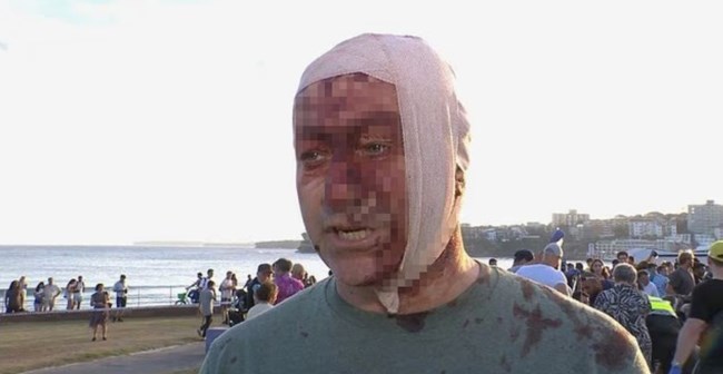 ΤΡΟΜΟΚΡΑΤΙΚΗ ΕΠΙΘΕΣΗ ΣΙΔΝΕΥ