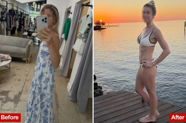 ΠΛΑΣΤΙΚΗ ΧΕΙΡΟΥΡΓΙΚΗ ΛΙΠΟΣ