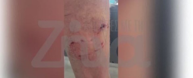 Ψάχνουν τη μητέρα του Τσιτσιπά για αυτόφωρο, μετά την επίθεση του σκύλου της σε 71χρονο - "Εβρισε τον ηλικωμένο και έφυγε"