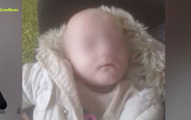 Αμαλιάδα: Οι διαφορές της ιατροδικαστικής με το πόρισμα του τεχνικού συμβούλου για τα σημάδια του μωρού της Κατερίνας