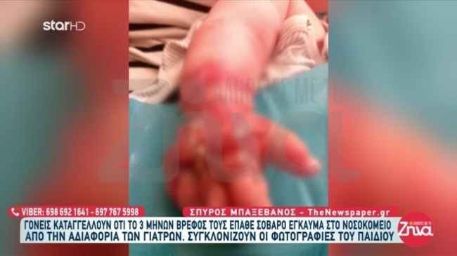 μωρο