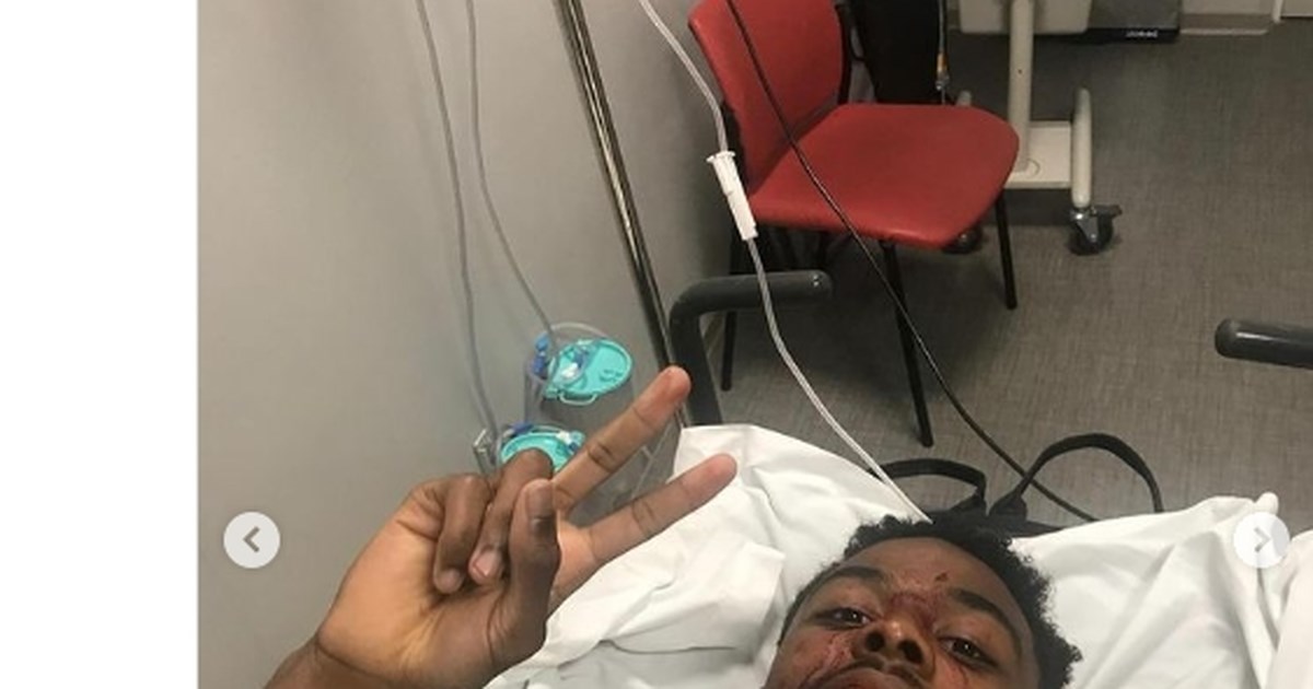 Αυτό είναι το πρώτο επίσημο τετράποντο στην ιστορία του μπάσκετ - Έγραψε ιστορία ο Κρις Μπανκέρο από τα 8,20μ [βίντεο]