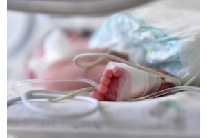 Θεσσαλονίκη: Μάχη για τη ζωή του δίνει το 2χρονο κοριτσάκι - Τυλίχτηκε στις φλόγες το φόρεμά της μετά από ανάφλεξη βενζίνης