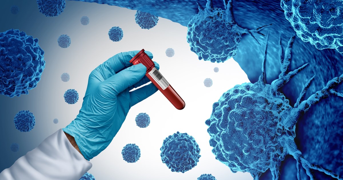 Πώς θα μειώσουμε τις πιθανότητες εμφάνισης καρκίνου: 5 αλλαγές που μπορούμε να κάνουμε σήμερα