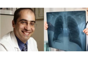 Ιταλία: Γιατροί μεταμόσχευσαν για πρώτη φορά την ωχρά κηλίδα του αμφιβληστροειδούς - Επανεφέραν την όραση σε τυφλή γυναίκα