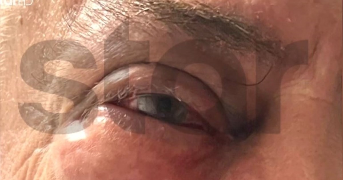 Γλυφάδα: Συνελήφθη ο Ισραηλινός για τον ξυλοδαρμό του επιχειρηματία στο εστιατόριο - Αρνείται ότι του χρωστάει λεφτά