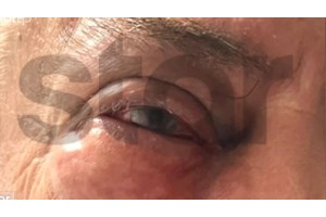 Γλυφάδα: Συνελήφθη ο Ισραηλινός για τον ξυλοδαρμό του επιχειρηματία στο εστιατόριο - Αρνείται ότι του χρωστάει λεφτά