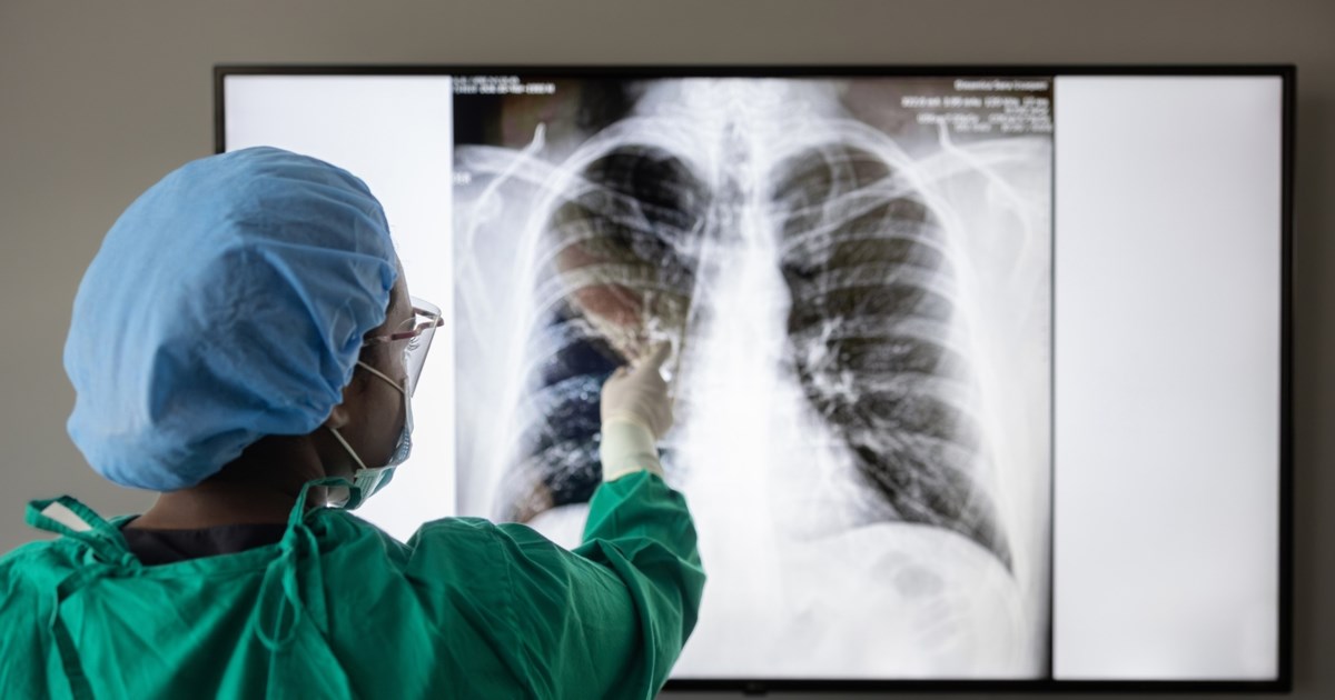 Απίστευτο: 33χρονος έζησε χωρίς πνεύμονες για 48 ώρες - Πώς συνέβη