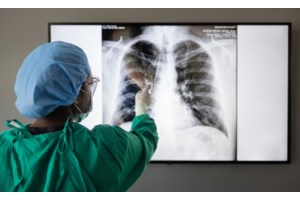 Απίστευτο: 33χρονος έζησε χωρίς πνεύμονες για 48 ώρες - Πώς συνέβη