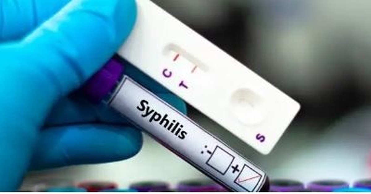 Συναγερμός στις ΗΠΑ: Καταγράφηκε θάνατος από πανώλη μετά από 18 χρόνια