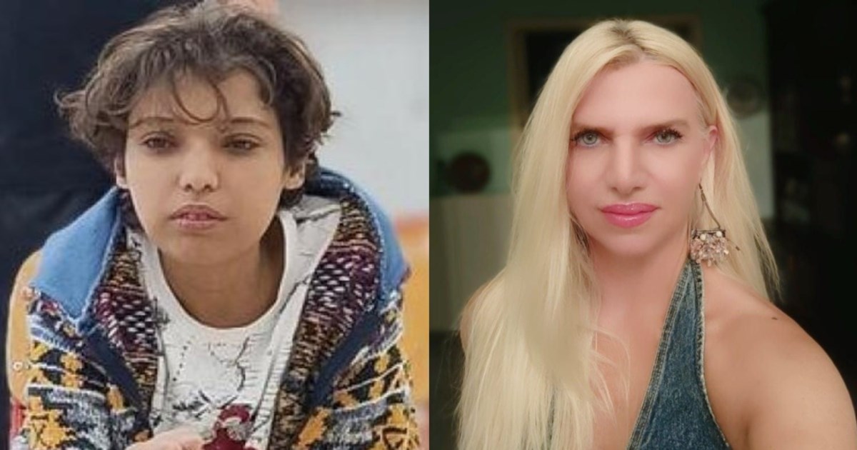 Δυσάρεστα νέα από την πρώτη μεταμόσχευση του 2026: Κατέληξε 50χρονος λήπτης ήπατος από 44χρονο