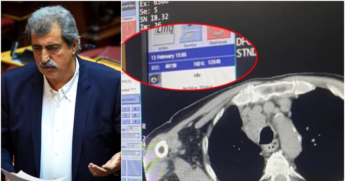 ΣΥΡΙΖΑ: Απείχαν Πολάκης - Ηλιόπουλος, παρών ψήφισε η Κασιμάτη για τα ομόφυλα  - Τι θα κάνει ο Κασσελάκης με τους "αντάρτες" - εικόνα 2