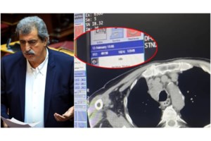 ΣΥΡΙΖΑ: Απείχαν Πολάκης - Ηλιόπουλος, παρών ψήφισε η Κασιμάτη για τα ομόφυλα - Τι θα κάνει ο Κασσελάκης με τους "αντάρτες" - εικόνα 2