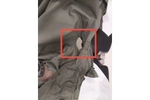 Θεσσαλονίκη: Εκπνέει η προθεσμία του υπουργείου Παιδείας προς το ΑΠΘ για τα σοβαρά επεισόδια