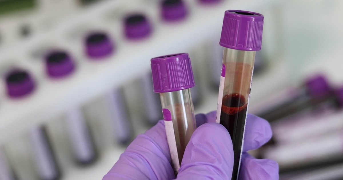 Κορονοϊός: Στους 27 οι θάνατοι, 42 άνθρωποι διασωληνωμένοι – 1 θάνατος από γρίπη - εικόνα 2