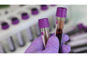 Κορονοϊός: Στους 27 οι θάνατοι, 42 άνθρωποι διασωληνωμένοι – 1 θάνατος από γρίπη - εικόνα 2