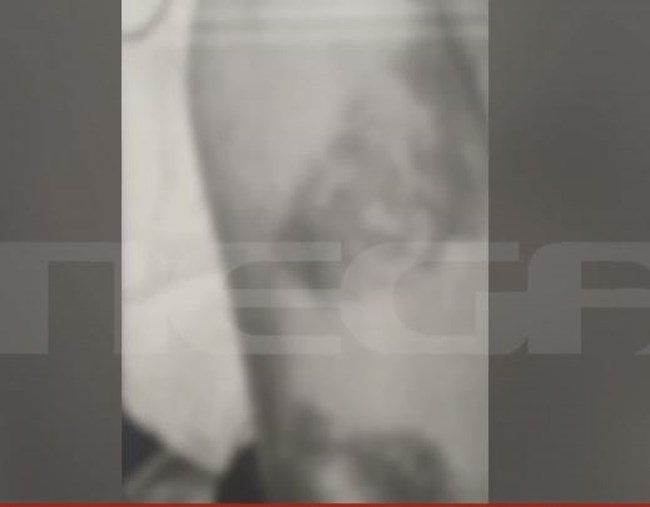 "Με νάρκωσε, με χτύπησε και με βίασε": Τι καταγγέλλει η 27χρονη καθηγήτρια για τον επιχειρηματία από τη Μύκονο [Βίντεο]