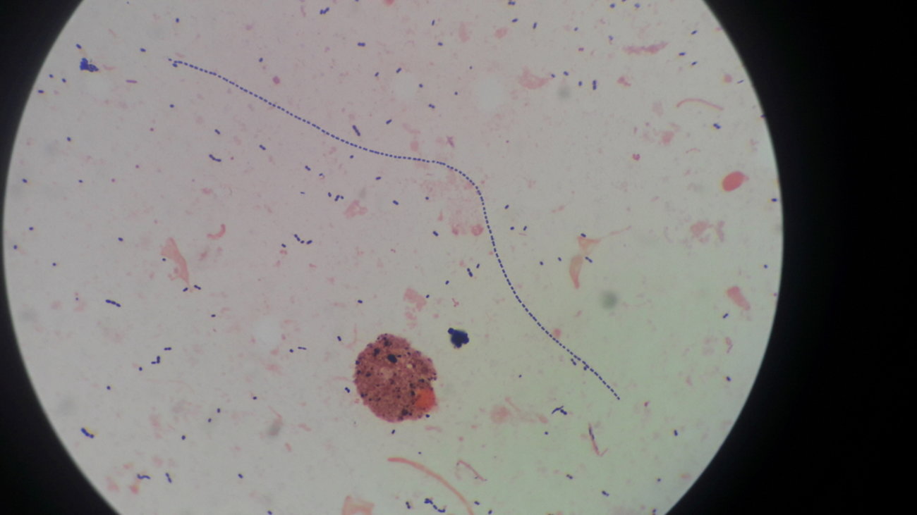 Καμπανάκι ECDC για στρεπτόκοκκο: Πού οφείλεται η ξαφνική έκρηξη κρουσμάτων, ποια συμπτώματα να προσέχουν οι γονείς