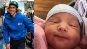 Τζάστιν Μπίμπερ: Παρέλυσε το μισό πρόσωπό του, πάσχει από το σπάνιο σύνδρομο Ramsay Hunt - Σοκάρει το βίντεο του - εικόνα 2