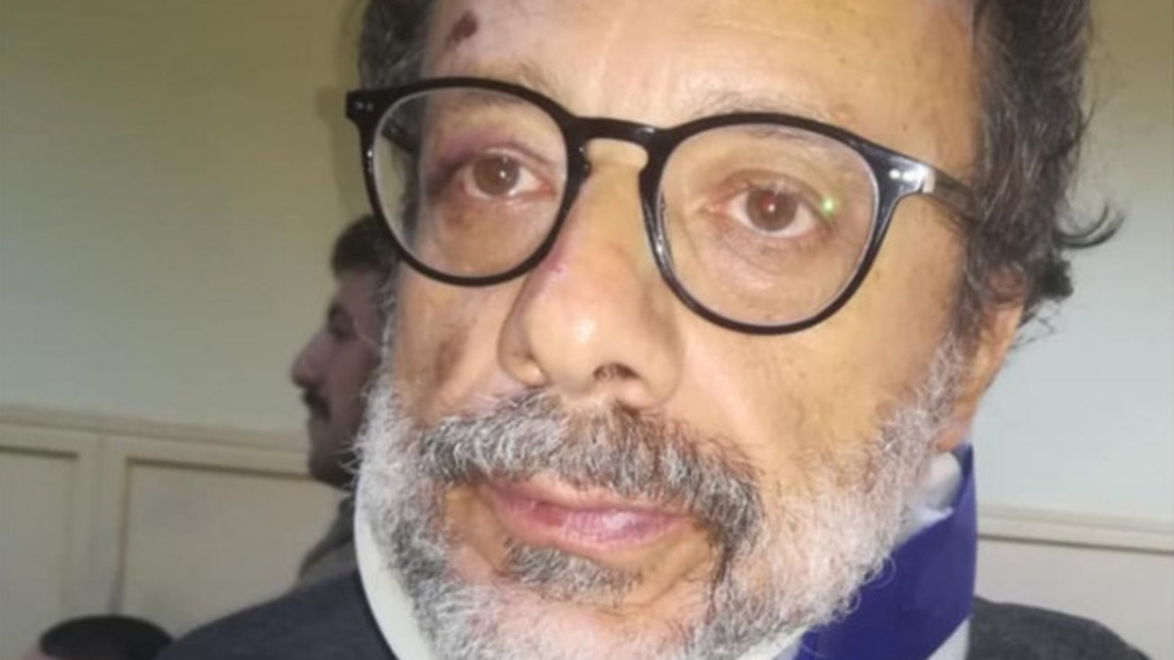 Δίκη Ινδαρέ: "Έφαγα πυροσβεστήρα στο κεφάλι - Πέταξαν ακόμη και ψυγείο" - Τι κατέθεσαν οι αστυνομικοί - εικόνα 4