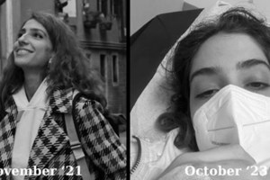 "Δεν είμαι λειτουργική, πάω μέχρι το μπάνιο και αυτό με πολύ δυσκολία" - Ο εφιάλτης 25χρονης με το σύνδρομο Long Covid