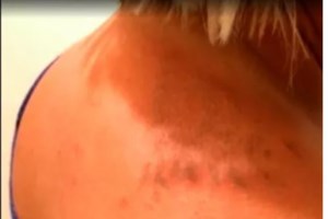 Μωβ μέδουσες: Συναγερμός για την επέλασή τους στις ελληνικές θάλασσες - Σε ποιες περιοχές εντοπίζονται [Χάρτης]