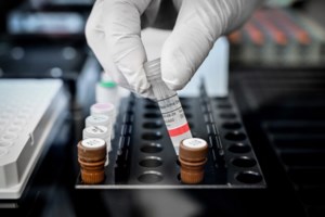 ΠΟΥ-Προσοχή στην άρση περιορισμών: Θα οδηγήσει σε "φονική επανεμφάνιση" της πανδημίας - εικόνα 2