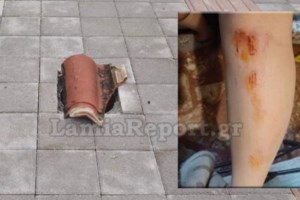 Επεισόδιο στη Λαμία: Γονείς χτύπησαν μαθητές που είχαν επιτεθεί στα παιδιά τους