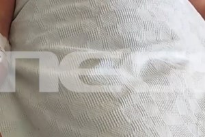 Ομοφοβική επίθεση στο Πήλιο: Δεν θα σκύβουμε το κεφάλι, λέει το θύμα