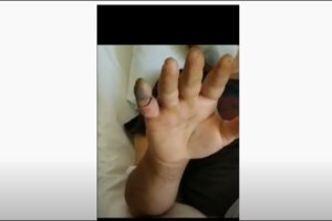 Γίνεται του ...φιδιού μετά την καραντίνα: Πολλά περιστατικά σε Πάτρα, Σύβοτα, Μεσολόγγι