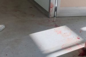 Τραγωδία στο "Αττικόν": Κικίλιας και Τσιόδρας επισκέφθηκαν τη νοσηλεύτρια που δέχθηκε επίθεση [εικόνες]