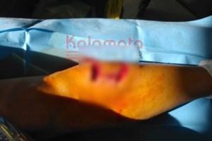 Καλαμάτα: Νέα επίθεση αδέσποτων σκύλων - Τραυματίστηκε σοβαρά γυναίκα με μηχανάκι [βίντεο - εικόνες]