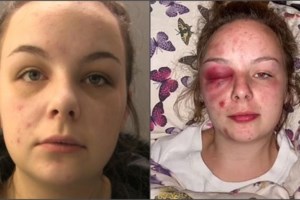 Αγρίνιο: Συνελήφθη 25χρονος για απόπειρα βιασμού σε βάρος ανηλίκου - Πώς έσωσε το παιδί μια καθαρίστρια