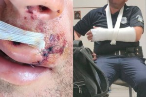 Σοκ στην Κυψέλη: Γυναίκα βρέθηκε αιμόφυρτη σε πεζοδρόμιο