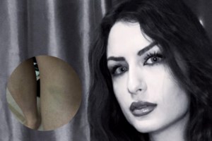 Βιασμός 24χρονης στη Θεσσαλονίκη: Θα δώσει νέα κατάθεση την Παρασκευή - Ίσως ταυτοποιηθεί και άλλο πρόσωπο