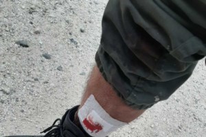 Στις φλόγες παραδόθηκε το κέντρο υποδοχής μεταναστών στη Συκαμνιά Λέσβου - εικόνα 2