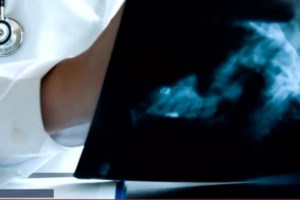 Αγαπηδάκη για προσωπικό γιατρό: Μέχρι τέλος Ιουνίου θα προστεθούν επιπλέον γιατροί