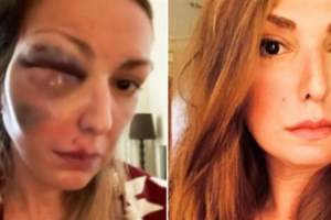 Κρήτη - Δύναμη ψυχής: Οδήγησε για 1,5 χιλιόμετρο το τρακτέρ με κομμένο πόδι