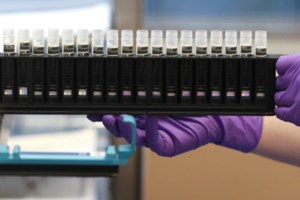 Κορονοϊός: 474 νεκροί σε 24 ώρες στη Νέα Υόρκη - Ο χαμηλότερος αριθμός για τον Απρίλιο