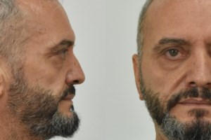 Κολωνός: Συμπληρωματική κατάθεση έδωσε η μητέρα της 12χρονης – Τι ζητά η υπεράσπισή της