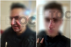 Επεισόδια στο Σύνταγμα: 117 βόμβες μολότοφ εκτοξεύτηκαν εναντίον των αστυνομικών σε 50 λεπτά - Στόχευαν τα κεφάλια - εικόνα 2