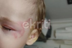 Κρήτη: Περιγραφή σοκ του πατέρα του βρέφους για την επίθεση από λυκόσκυλο - "Χύμηξε πάνω στο παιδί να του βγάλει τα μάτια" - εικόνα 4