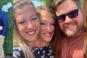 Δύο ζωές σε ένα σώμα: Πώς ζουν και πώς ονειρεύονται να αποκτήσουν παιδιά οι πιο διάσημες σιαμαίες δίδυμες [εικόνες] - εικόνα 8