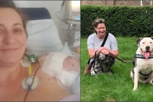 Εφιάλτης για Βραζιλιάνα χορεύτρια: Μπήκε στο νοσοκομείο για αφαίρεση ινομυωμάτων και της ακρωτηρίασαν το χέρι - εικόνα 3