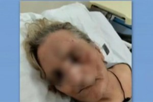 Τουρκία: "Πα-τέρας" ξυλοκόπησε άγρια το 3 μηνών παιδί του επειδή έκλαιγε [εικόνες - βίντεο] - εικόνα 2